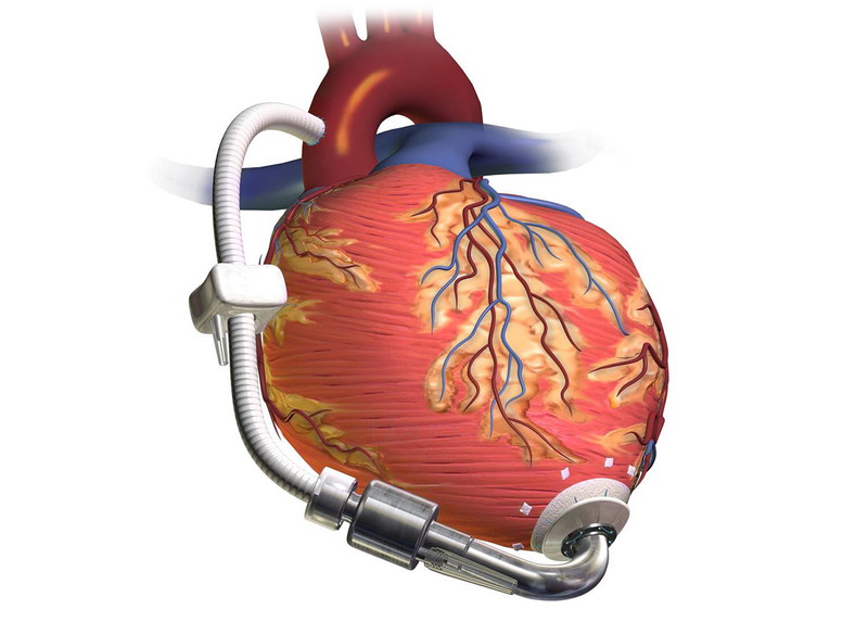Diagrama de una válvula cardíaca. Foto: Blausen Medical, vía Wikimedia Commons